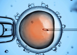 THỤ TINH ỐNG NGHIỆM IVF - NHỮNG ĐIỀU CẦN BIẾT