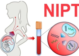 Xét nghiệm trước sinh không xâm lấn (NIPT) - Cách mạng trong tầm soát sớm bất thường di truyền